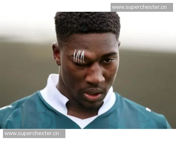 慎入，普利茅斯球员佩普尔比赛中眼睛被撞得肿到睁不开